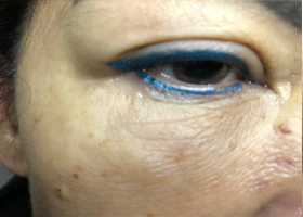 eyebrows