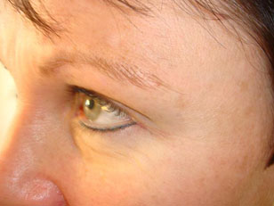 eyebrows