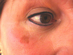 eyebrows