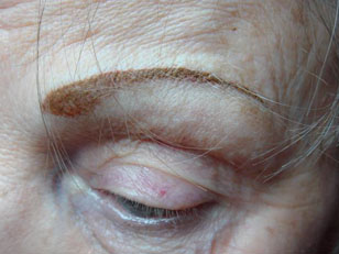 eyebrows