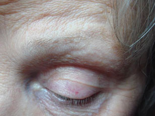 EYEBROWS