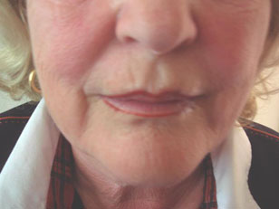 eyebrows