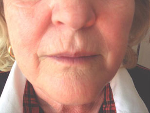 EYEBROWS
